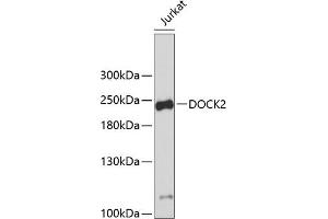 Western blot analysis of extracts of Jurkat cells, using DOCK2 antibody (ABIN1679578, ABIN5664348 and ABIN5664349). (DOCK2 抗体  (AA 1551-1830))
