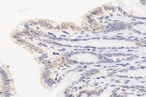 Immunohistochemistry analysis of paraffin-embedded rat colon using,TMEM177 (ABIN7075996) at dilution of 1: 1000 (TMEM177 抗体)