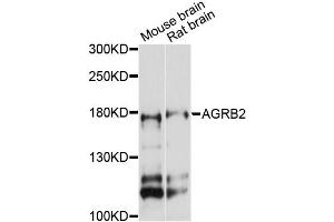 Western blot analysis of extracts of various cell lines, using AGRB2 antibody (ABIN6290298) at 1:3000 dilution. (BAI2 抗体)