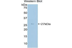 Western blot analysis of recombinant Mouse TGFbI. (TGFBI 抗体  (AA 423-632))