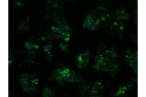 Image no. 6 for anti-Proteasome (Prosome, Macropain) 26S Subunit, ATPase, 3 (PSMC3) antibody (ABIN1501331) (PSMC3 抗体)