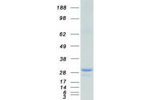 Western Blotting (WB) image for Catechol-O-Methyltransferase (COMT) (Transcript Variant 4) protein (Myc-DYKDDDDK Tag) (ABIN2712475)