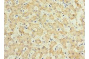 Immunohistochemistry of paraffin-embedded human liver tissue using ABIN7156807 at dilution of 1:100 (IL17 Receptor B 抗体  (AA 18-292))