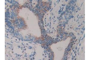 Detection of Slit1 in Human Prostate Tissue using Polyclonal Antibody to Slit Homolog 1 (Slit1)