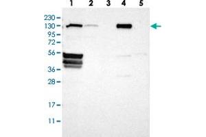 Western blot analysis of Lane 1: RT-4, Lane 2: U-251 MG, Lane 3: Human Plasma, Lane 4: Liver, Lane 5: Tonsil with FLII polyclonal antibody  at 1:250-1:500 dilution. (FLII 抗体)