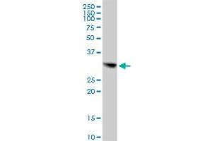 CBR1 MaxPab polyclonal antibody. (CBR1 抗体  (AA 1-277))