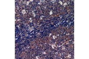 Immunohistochemical analysis of p47 phox staining in human tonsil formalin fixed paraffin embedded tissue section. (NCF1 抗体  (C-Term))