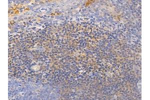 ABIN6255915 and ABIN6267457 at 1/100 staining human normal tonsil tissue by IHC-P.