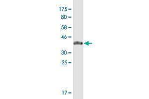 Western Blot detection against Immunogen (39. (ZNF585A 抗体  (AA 1-113))