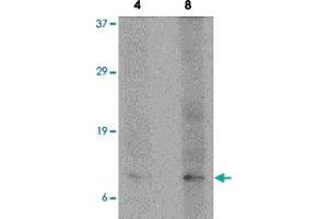 Western blot analysis of P53AIP1 in HL-60 cell lysate with P53AIP1 polyclonal antibody  at 4 and 8 ug/mL .
