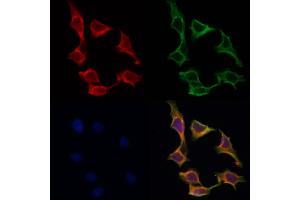 ABIN6259690 and ABIN6266757 staining Hela by IF/ICC. (ABCF1 抗体  (C-Term))