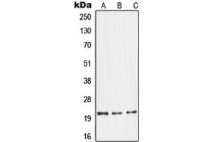 Western blot analysis of Glucagon expression in LO2 (A), mouse kidney (B), H9C2 (C) whole cell lysates. (Glucagon 抗体  (Center))