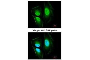 ICC/IF Image Immunofluorescence analysis of paraformaldehyde-fixed HeLa, using KIAA0494, antibody at 1:200 dilution. (KIAA0494 抗体  (Center))
