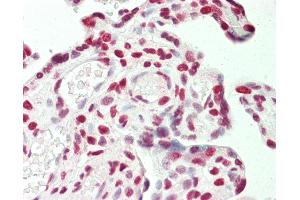Anti-STAG1 / SA1 antibody IHC staining of human placenta. (Stromal Antigen 1 抗体  (AA 25-75))