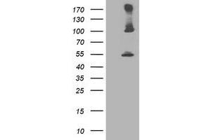 Western Blotting (WB) image for anti-Proteasome (Prosome, Macropain) 26S Subunit, Non-ATPase, 2 (PSMD2) antibody (ABIN1500481) (PSMD2 抗体)