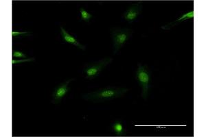 Immunofluorescence of monoclonal antibody to SRC on HeLa cell.