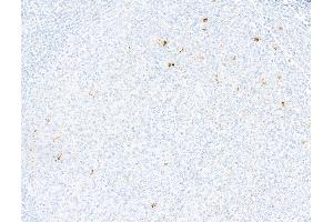 Immunohistochemistry (IHC) image for anti-Interleukin 10 (IL10) antibody (ABIN7795732)