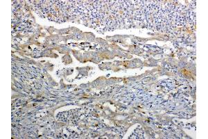 IHC analysis of GALNS using anti-GALNS antibody . (GALNS 抗体  (AA 181-289))