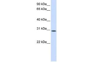 Western Blotting (WB) image for anti-Sushi Domain Containing 6 (SUSD6) antibody (ABIN2459068) (SUSD6/KIAA0247 抗体)