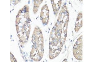 Immunohistochemistry of paraffin-embedded Human stomach using FAK Polyclonal Antibody at dilution of 1:100 (40x lens). (FAK 抗体)