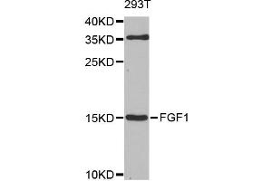 Western blot analysis of extracts of 293T cells, using FGF1 antibody.