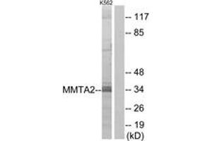 Western blot analysis of extracts from K562 cells, using MMTAG2 Antibody. (C1orf35 抗体  (AA 10-59))