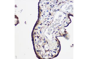 Immunohistochemistry of paraffin-embedded Human placenta using LRRK2 Rabbit pAb  at dilution of 1:100 (40x lens). (LRRK2 抗体  (AA 2355-2527))