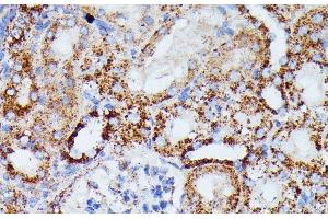 Immunohistochemistry (Paraffin-embedded Sections) (IHC (p)) image for anti-Isocitrate Dehydrogenase 3 (NAD+) alpha (IDH3A) antibody (ABIN7258018)