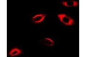 Immunofluorescent analysis of APRT staining in A549 cells. (APRT 抗体)