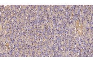 Detection of INSR in Human Pancreas Tissue using Monoclonal Antibody to Insulin Receptor (INSR) (Insulin Receptor 抗体)