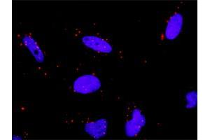 Proximity Ligation Analysis of protein-protein interactions between HSPA1L and TP53. (HSPA1L 抗体  (AA 1-641))