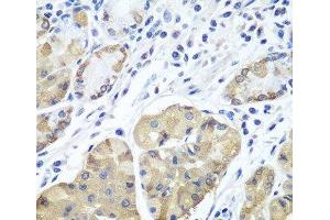Immunohistochemistry of paraffin-embedded Human stomach using PLCB2 Polyclonal Antibody at dilution of 1:100 (40x lens). (Phospholipase C beta 2 抗体)