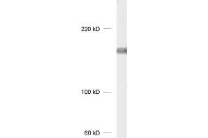 dilution: 1 : 1000, sample: Jurkat cell lysate