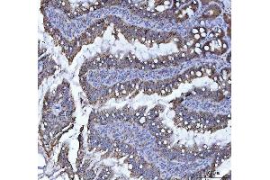 IHC analysis of LI Cadherin/CDH17 using anti-LI Cadherin/CDH17 antibody (ABIN7600855). (LI Cadherin 抗体  (AA 24-695))