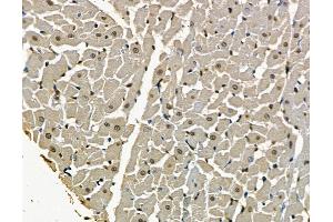 anti-Zinc Finger Protein 566 (ZNF566) antibody