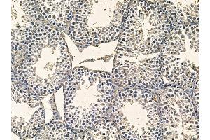 ABIN7095364 and ABIN7099421 at 1/100 staining mouse testis tissue by IHC-P. (WDR76 抗体)