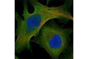 Immunofluorescent staining of human cell line U-2 OS shows positivity in nucleoli, plasma membrane & cytoplasm. (Myosin X 抗体)