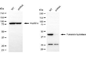 Western blotting analysis using fumarate hydratase antibody (ABIN7798663). (FH 抗体)