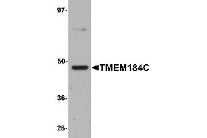 Western Blotting (WB) image for anti-Transmembrane Protein 184C (TMEM184C) (C-Term) antibody (ABIN1030749) (TMEM184C 抗体  (C-Term))