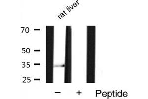 Western blot analysis of extracts of Rat liver lysates,using Phospho-Cyclin D1 (Ser90) Antibody . (Cyclin D1 抗体  (pSer90))