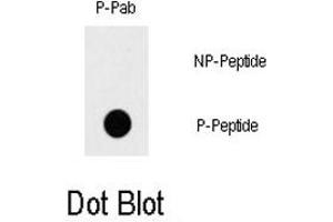 Dot blot analysis of MAP3K7 (phospho S192) polyclonal antibody  on nitrocellulose membrane.