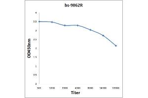 Antigen: 2 µg/100 µL  Primary: Antiserum, 1:500, 1:1000, 1:2000, 1:4000, 1:8000, 1:16000, 1:32000;  Secondary: HRP conjugated Rabbit Anti-Goat IgG at 1: 5000;  TMB staining Read the data in Microplate Reader by 450nm. (MYH7 抗体  (AA 1350-1390))