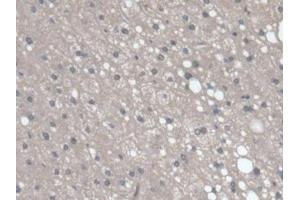 Detection of RGN in Human Liver Tissue using Polyclonal Antibody to Regucalcin (RGN) (Regucalcin 抗体  (AA 65-299))
