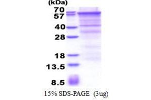 SDS-PAGE (SDS) image for Endoglin (ENG) (AA 26-586) protein (His tag) (ABIN6387366)
