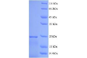 Interferon, alpha 14 (IFNa14) (AA 24-189) protein (His tag)