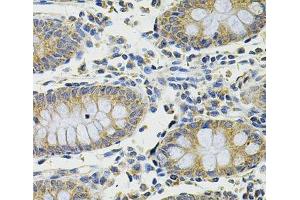 Immunohistochemistry of paraffin-embedded Human colon using DDX20 Polyclonal Antibody at dilution of 1:100 (40x lens). (DDX20 抗体)
