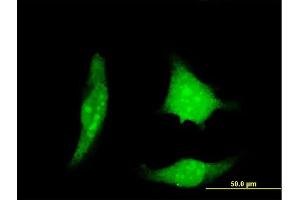 Immunofluorescence of monoclonal antibody to RCAN1 on HeLa cell. (RCAN1 抗体  (AA 1-100))