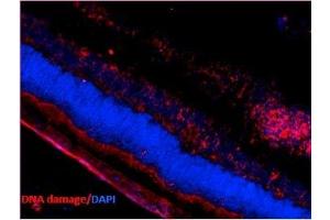 Immunohistochemistry analysis using Mouse Anti-DNA Damage Monoclonal Antibody, Clone 15A3 (ABIN361743 and ABIN361744). (DNA Damage 抗体)