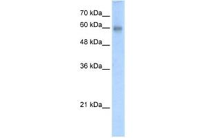 WB Suggested Anti-RCOR2 Antibody Titration:  5. (Rcor2 抗体  (N-Term))