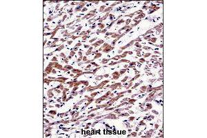 Immunohistochemistry (Formalin/PFA-fixed paraffin-embedded sections) of human heart tissue with MOV10 polyclonal antibody  followed by peroxidase conjugation of the secondary antibody and DAB staining.
